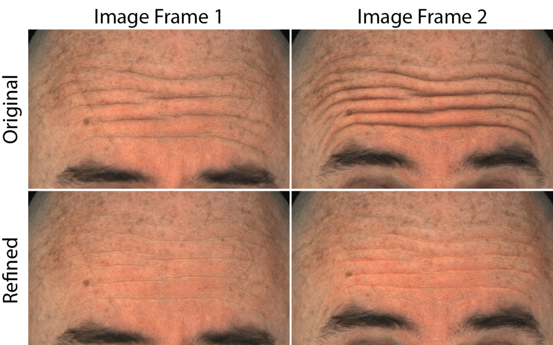 Improved Reconstruction of Deforming Surfaces by Cancelling Ambient Occlusion