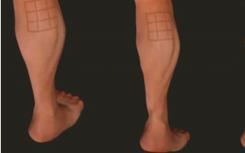 Dynamic Skin Deformation SimulationUsing Musculoskeletal Model and Soft Tissue Dynamics