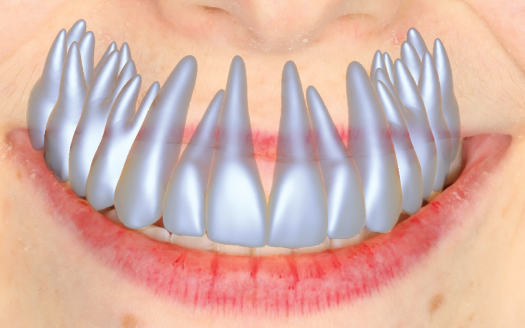 Model-Based Teeth Reconstruction