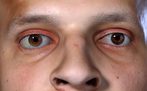 Practical Person-Specific Eye Rigging