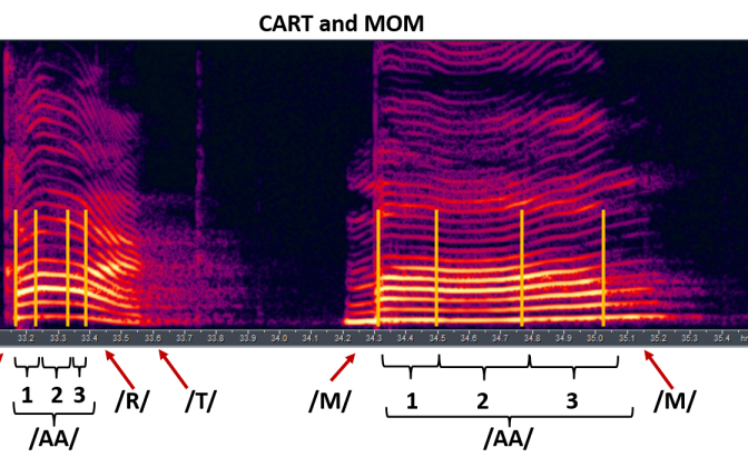 Estimation of Children’s Physical Characteristics from their Voices