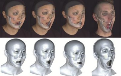 Accurate Markerless Jaw Tracking for Facial Performance Capture