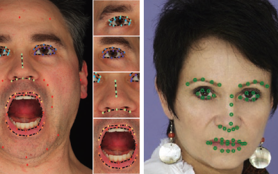 Attention-Driven Cropping for Very High Resolution Facial Landmark Detection